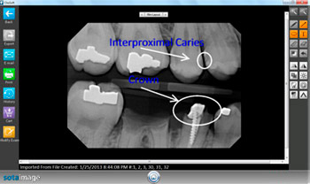 dental imaging software 6.14.7